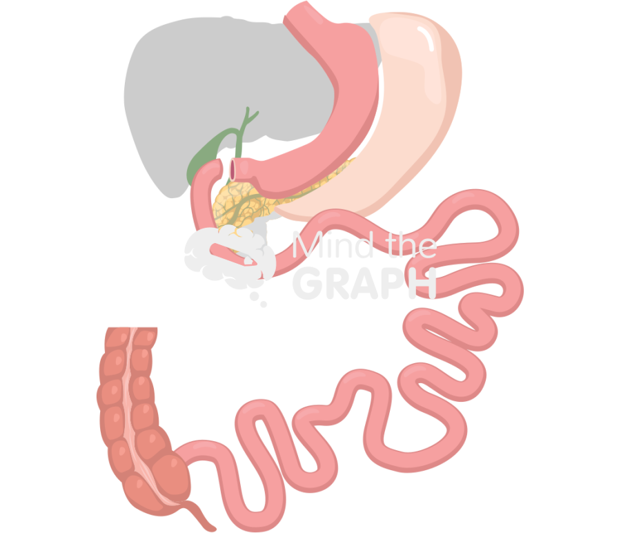 Sadis gastrectomy procedure Icons, Symbols, Pictures, and Images